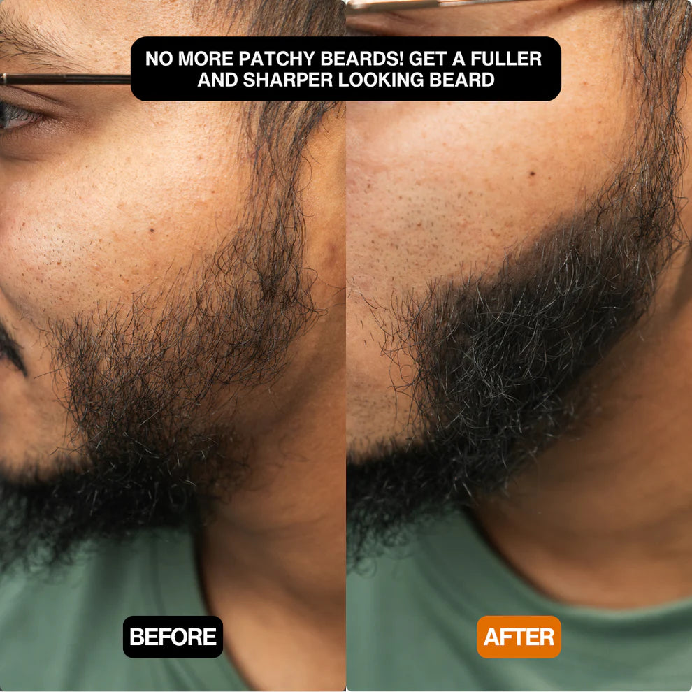 Polvo para Cabello - Sevich