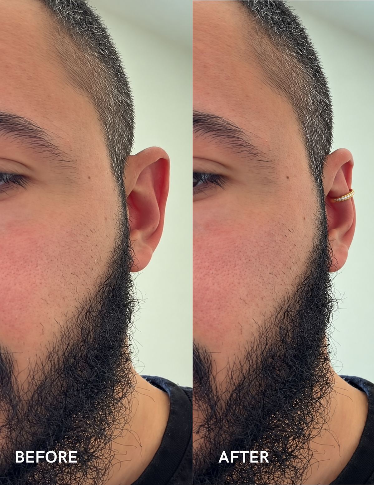 Aurix Instant Aesthetic Ear Corrector