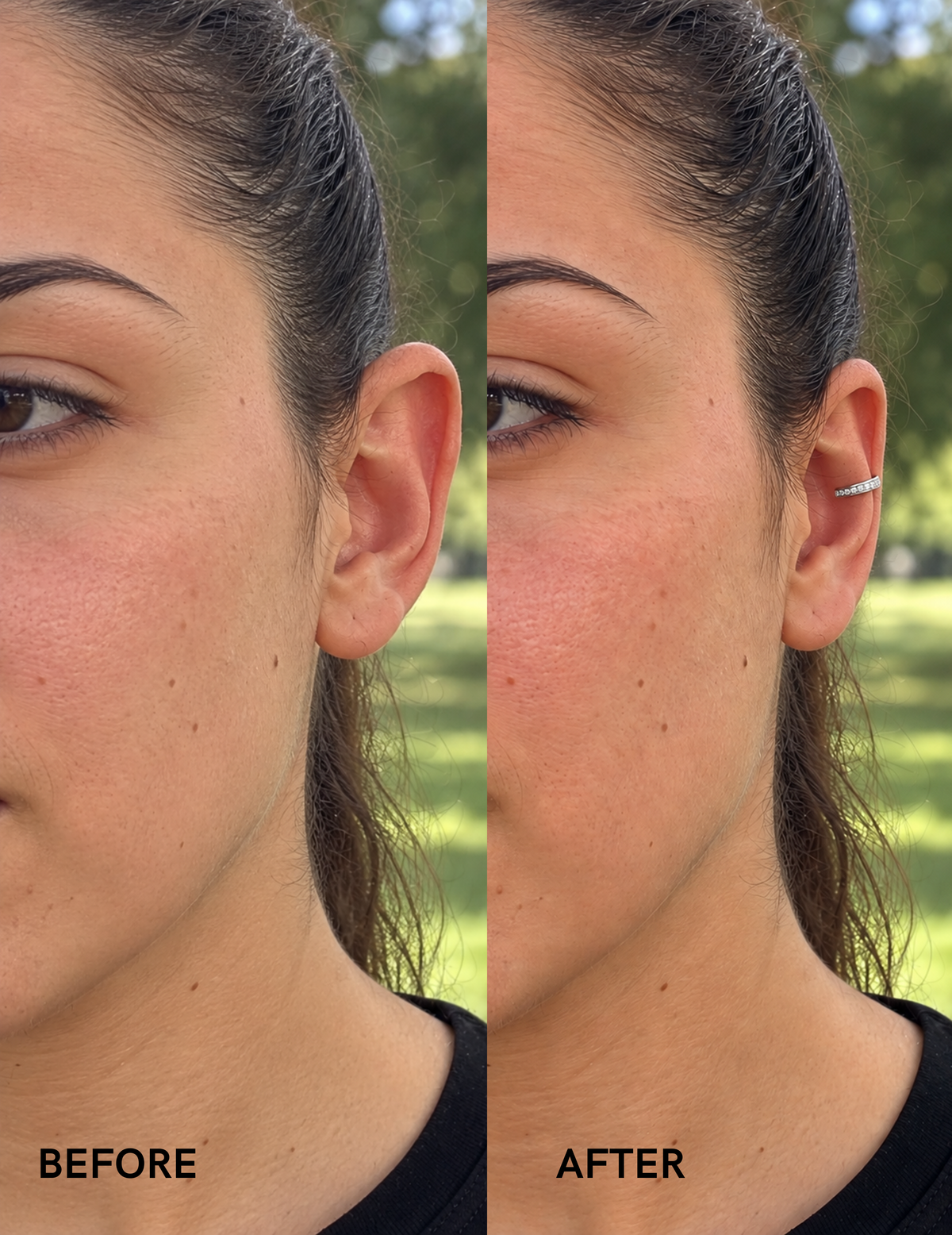Aurix Instant Aesthetic Ear Corrector