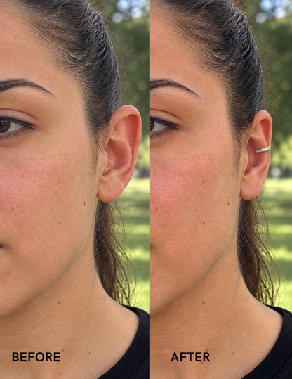 Aurix Instant Aesthetic Ear Corrector