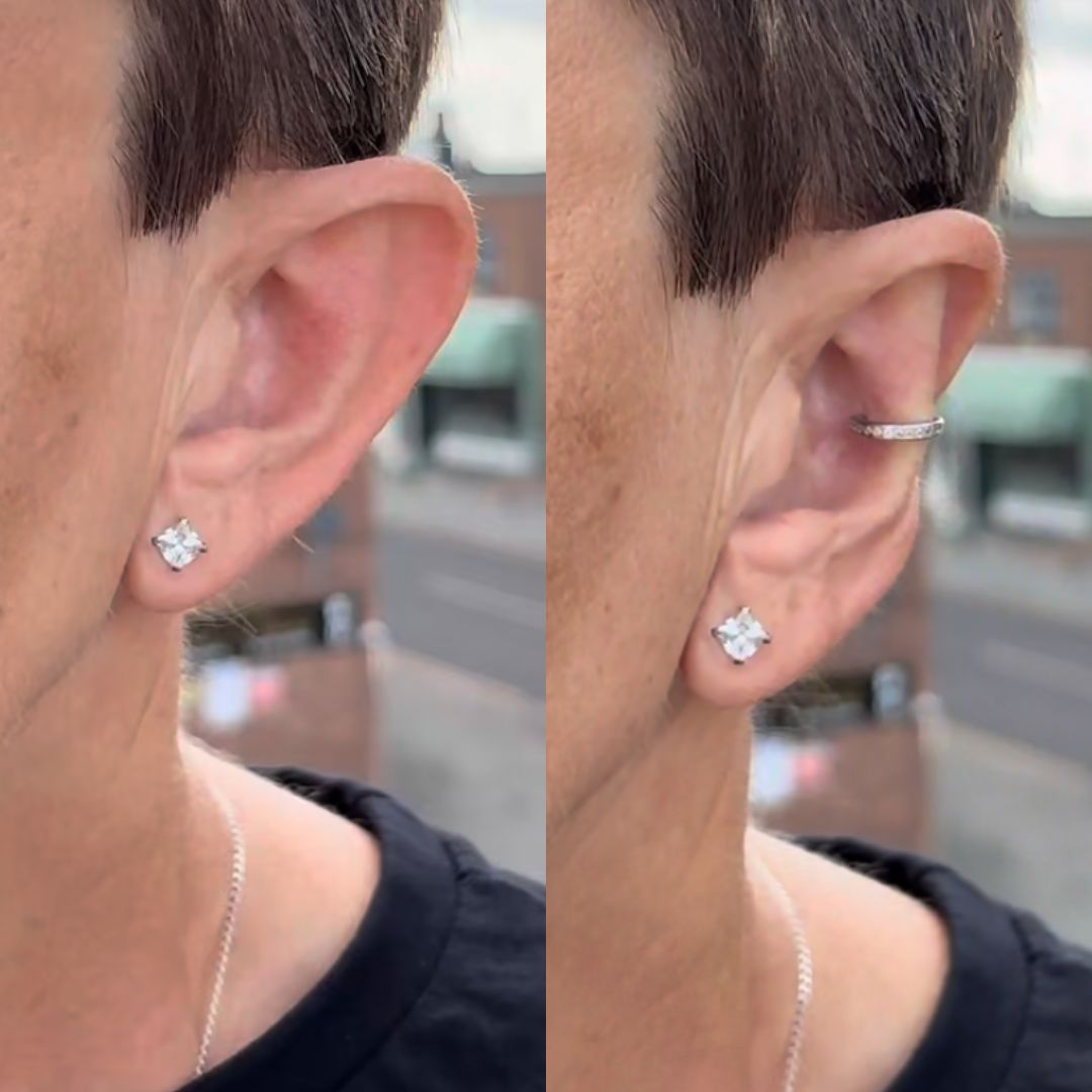 Aurix 925 Plata - Corrección Estética de Orejas sin Cirugía