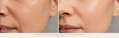 Anti-Age Peptide Collection